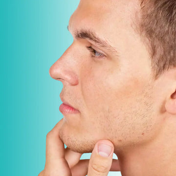 Depilación Láser Mentón (Para Hombre) - 1 sesión - LASKIN