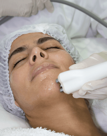 Radiofrecuencia Facial - Flacidez - 1 sesión - LASKIN