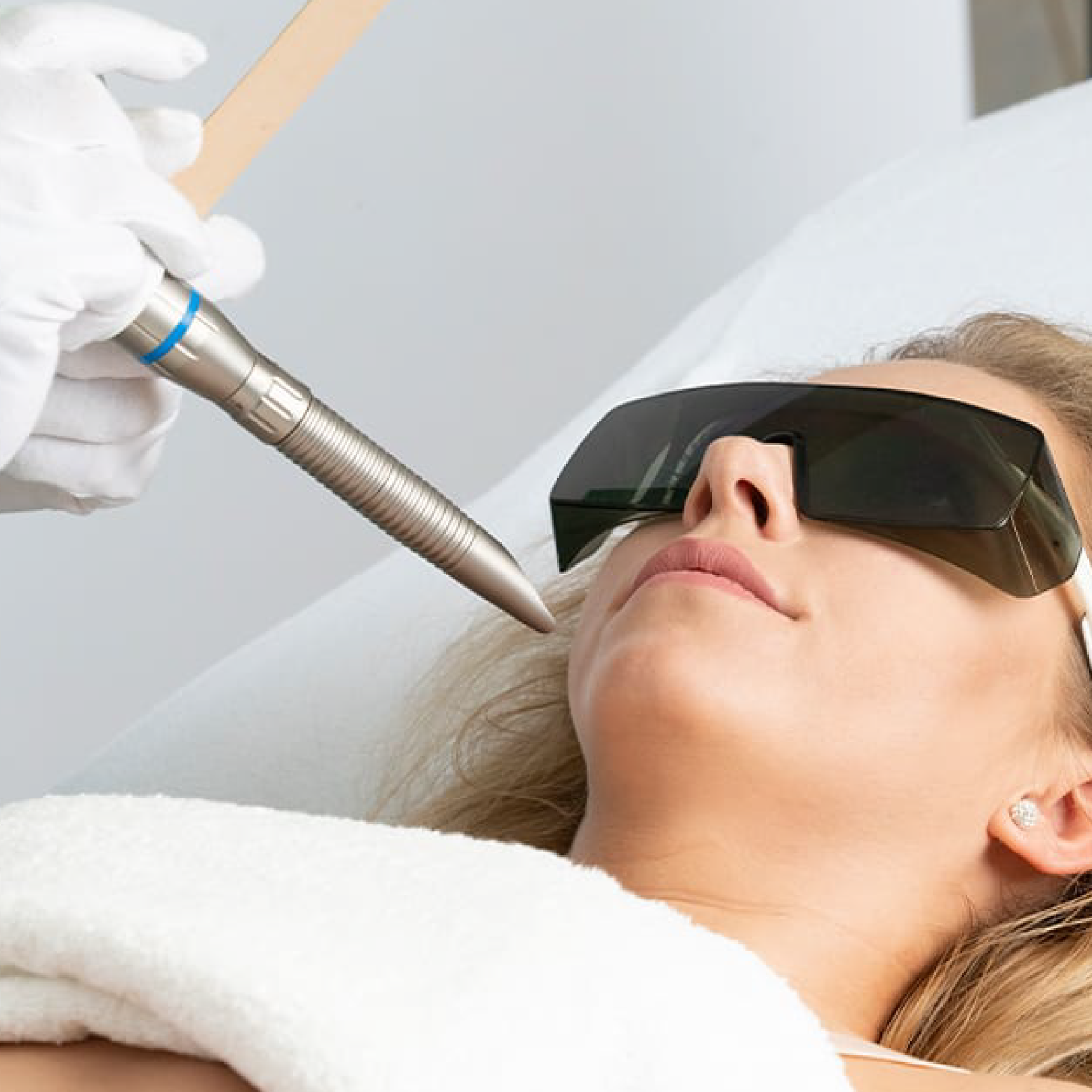 Peeling X1 Sesión 15%OFF Dynamis®