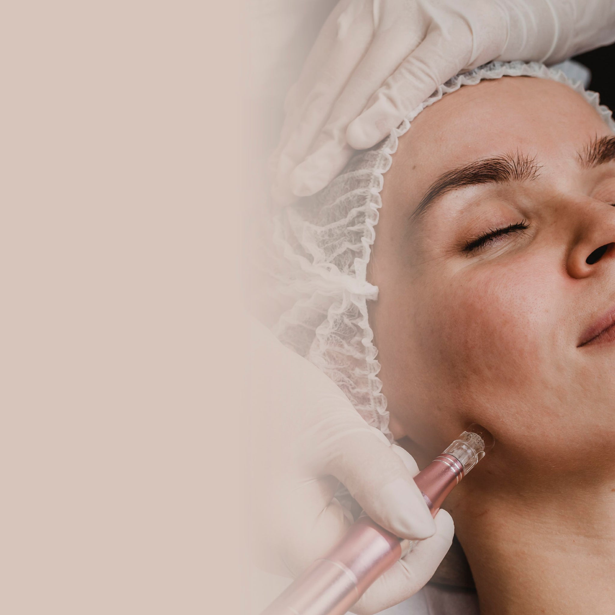 Silkpeel con Vitamina C - 35% OFF - 1 Sesión