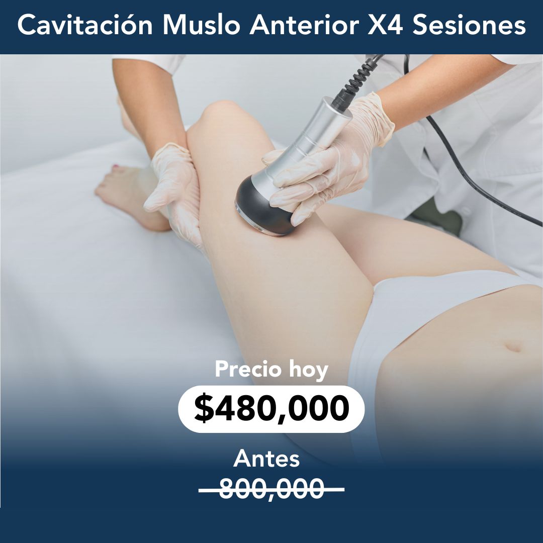 Cavitación Muslo Anterior 40% Dcto - 4 Sesiones