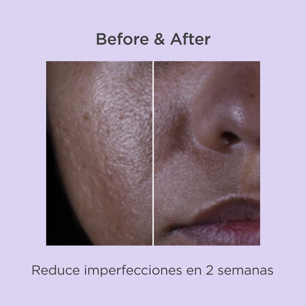 Suero Renovador Salicílico ISDINCEUTICS x30ml ISDIN®