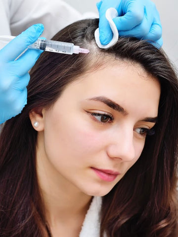Consulta Dermatológica + Aplicación Mesoterapia Capilar para tratar la Alopecia X 1 Sesión 15% dct