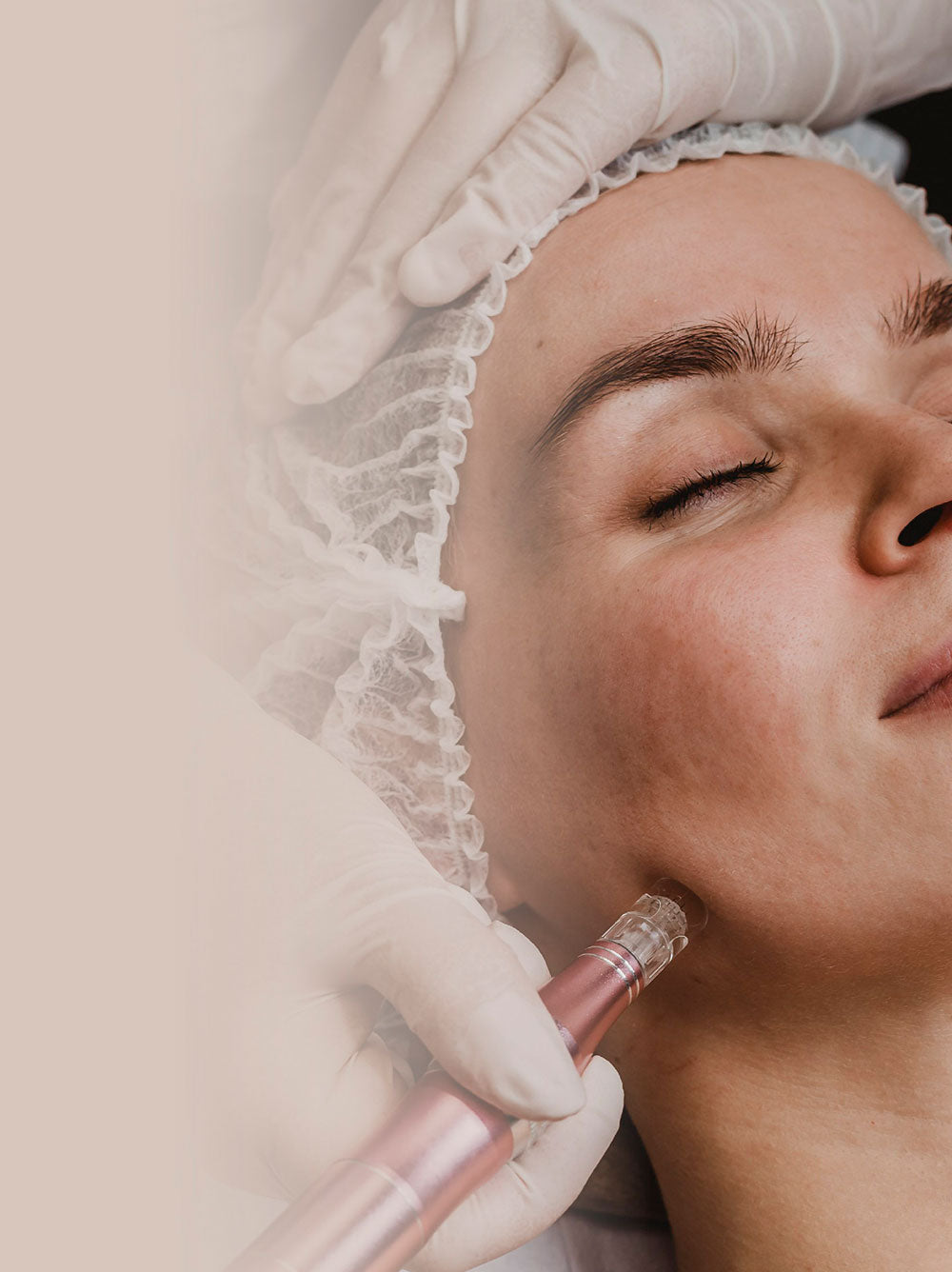 Silkpeel® Vitamina C - 25% Dcto - 1 Sesión