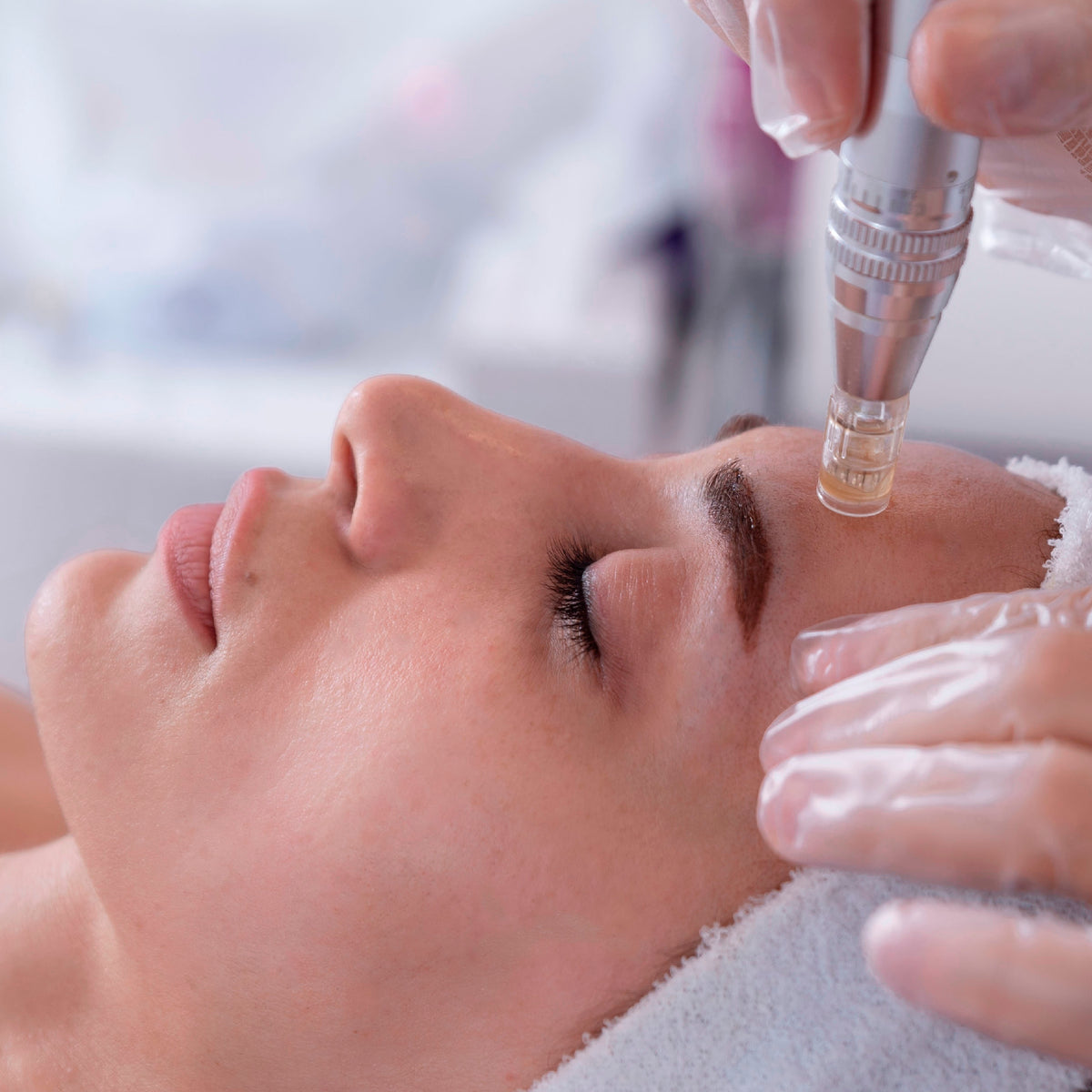 Aplicación Exosomas con Dermapen 1.5ml X 1 SESION 15% Dct.